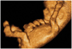 Baby Ultraschall
