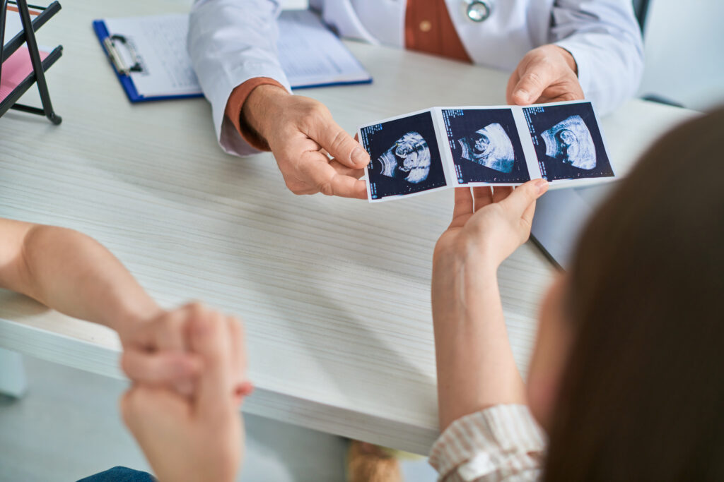 ultraschallbilder vom baby man sieht die Hände der Ärztin die der Patientin die Ultraschallbilder zeigt